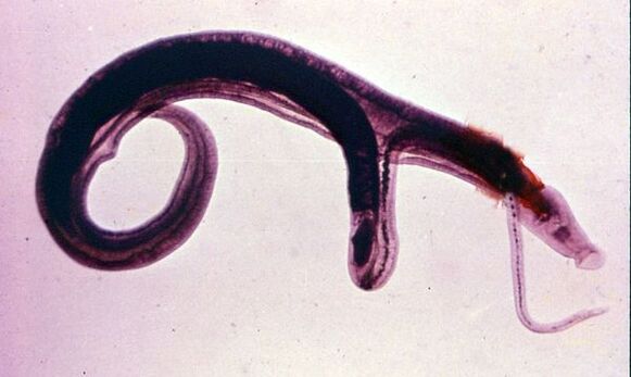 Şistozomlar en yaygın ve tehlikeli parazitlerden biridir